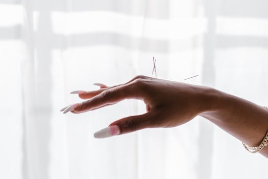 Balancing Pain Relief: The Power of Acupuncture